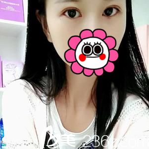 术后14天效果 术后14天效果