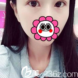 术后21天效果 术后21天效果