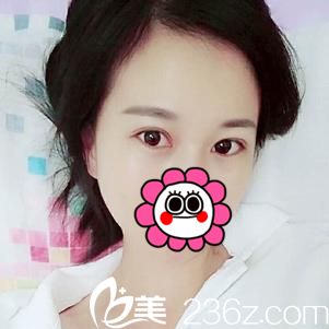 术后28天效果 术后28天效果