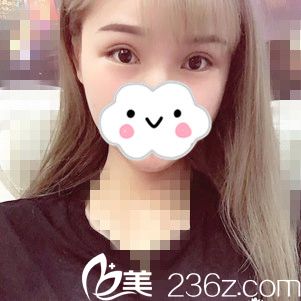 手术后半个月 手术后半个月