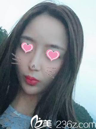 第10天了 第10天了