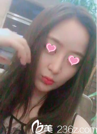 术后16天 术后16天