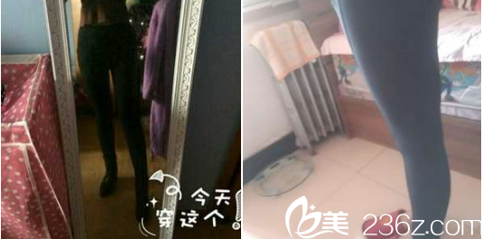 现在已经瘦了很明显了