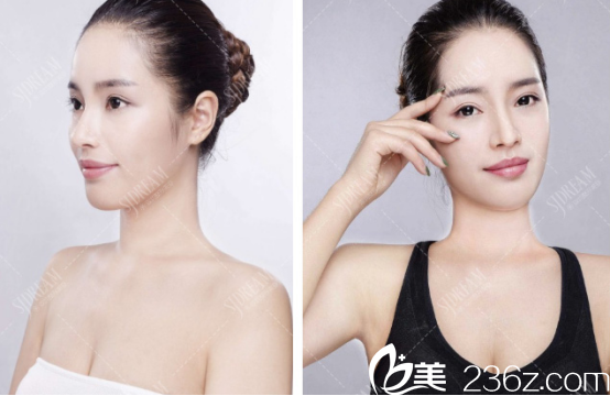 隆鼻后秒变女神