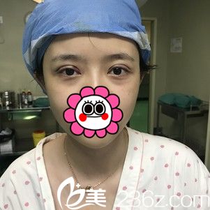 手术后即刻效果 手术后即刻效果