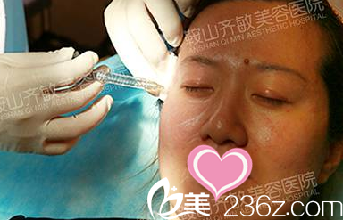 玻尿酸丰太阳穴