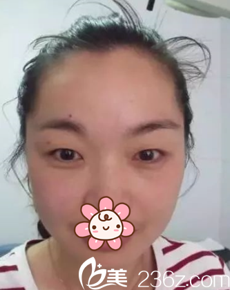 去新疆伊丽莎白整形医院前 去新疆伊丽莎白整形医院前