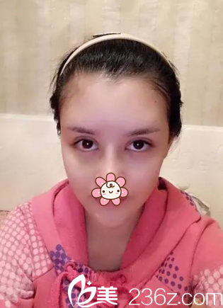 蛮高兴每天都有一点点好的变化