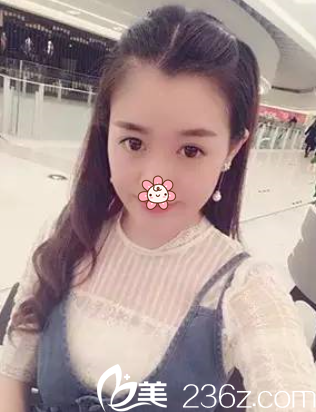 术后快一个月时候