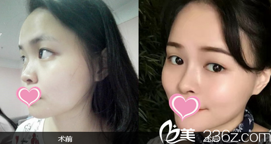 北京米扬丽格医疗美容医院案例