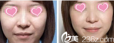 北京米扬丽格医疗美容医院案例