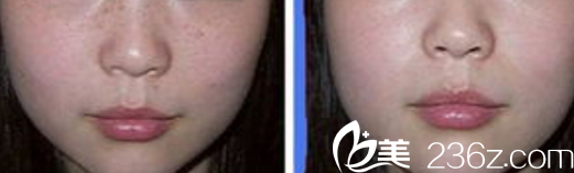 北京米扬丽格医疗美容医院案例 北京米扬丽格医疗美容医院案例