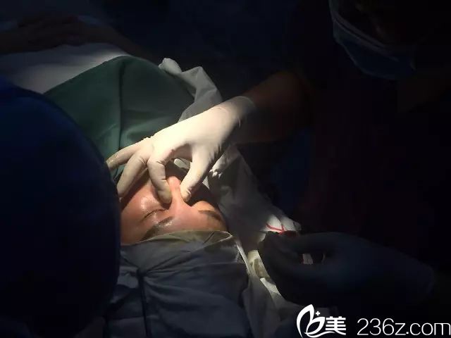 膨体假体植入术进行 膨体假体植入术进行