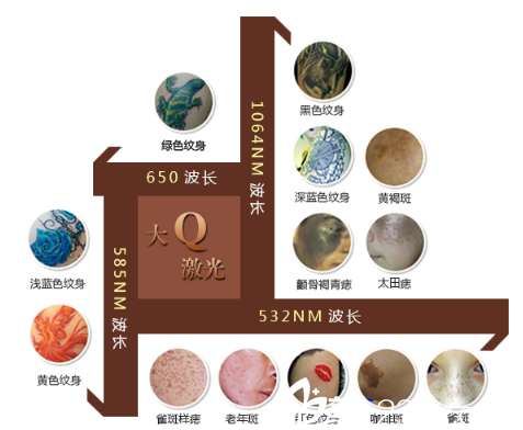 祛斑美容走进大Q时代