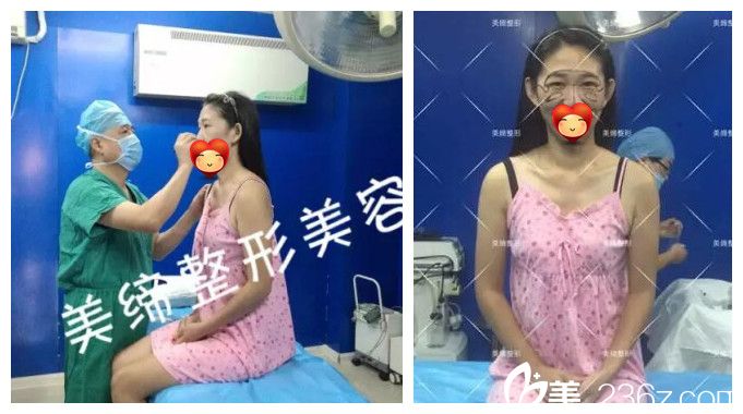 整形术前划线设计 整形术前划线设计