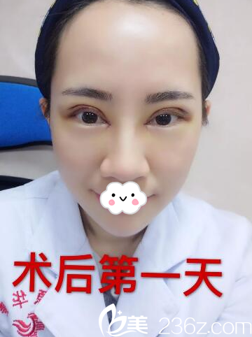 河源华美何为院长双眼皮天 河源华美何为院长双眼皮天