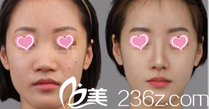 北京清木医疗美容诊所案例