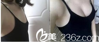 北京清木医疗美容诊所案例