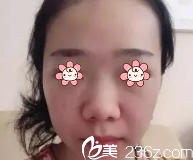 这鼻子,我是醉醉的 这鼻子,我是醉醉的