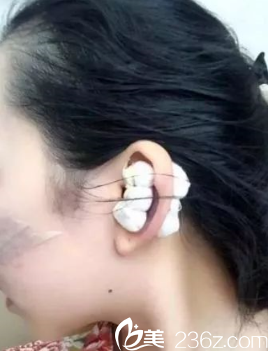 耳朵也给包着 耳朵也给包着