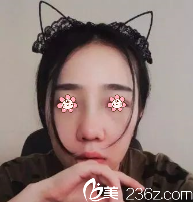 刚拆完线 刚拆完线