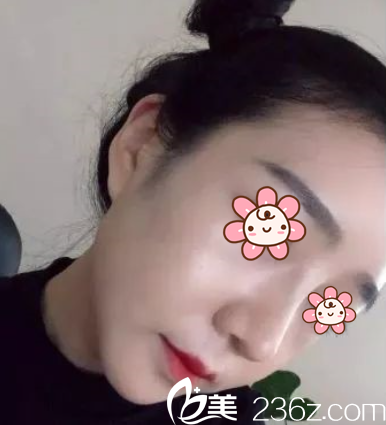 <!--<i data=20240703-sp></i>-->凤医生给我做完半个多月过去了 <!--<i data=20240703-sp></i>-->凤医生给我做完半个多月过去了