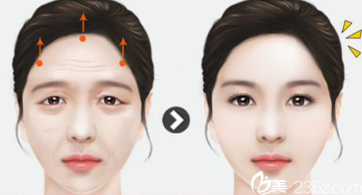 安多泰提眉术 安多泰提眉术