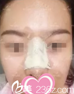 术后当时效果 术后当时效果