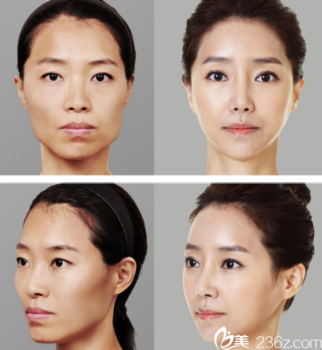 LET美人2》朴华成 LET美人2》朴华成