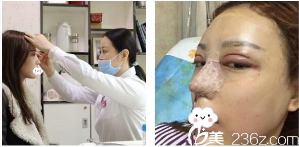 李光琴医生面诊过程 李光琴医生面诊过程