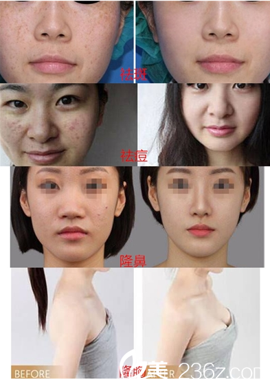 重庆光博士整形真人 重庆光博士整形真人