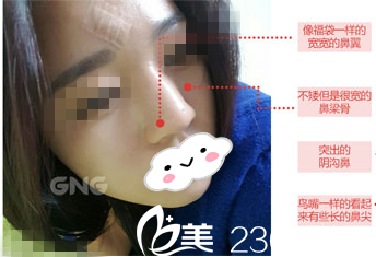 手术前的我 手术前的我