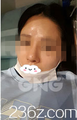 术后一周 术后一周