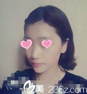 韩国LUX整形医院 韩国LUX整形医院