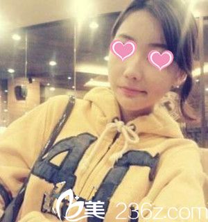 手术后三周 手术后三周