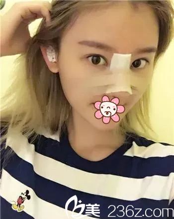 三天后状态还不错