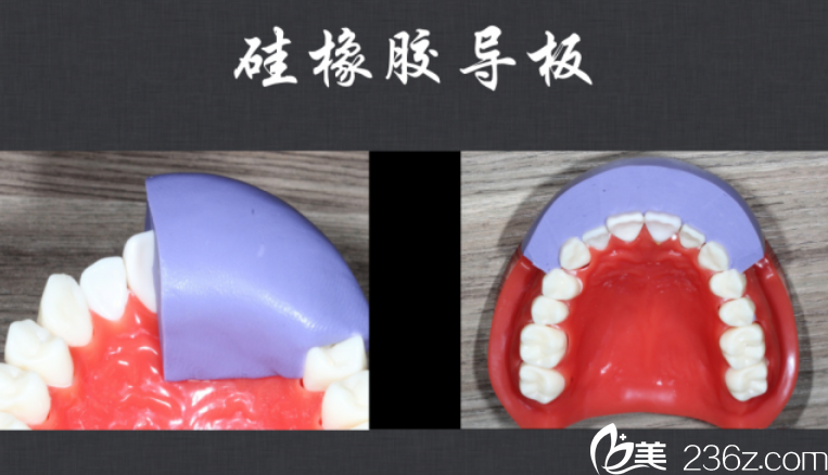 牙体模型