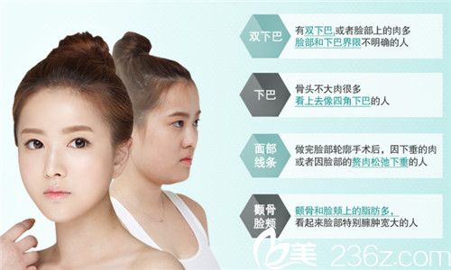 beautyline俞院长的案例