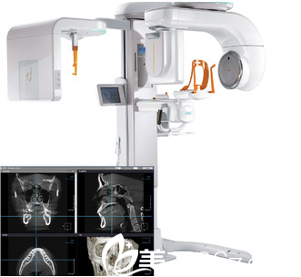 先进的3D-CT仪器 先进的3D-CT仪器