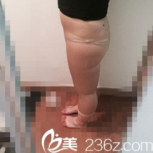 手术前的我 手术前的我