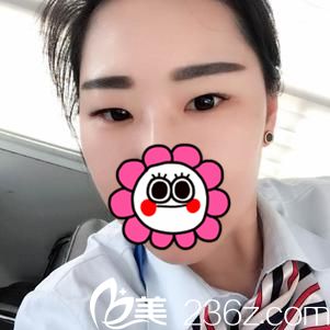 术前样貌 术前样貌