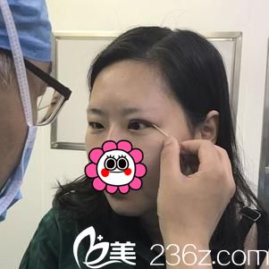 医生在设计手术方案 医生在设计手术方案