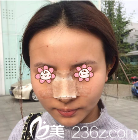 院长安相泰亲自给我做的手术 院长安相泰亲自给我做的手术