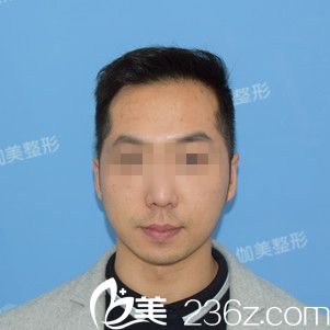 术前正面 术前正面