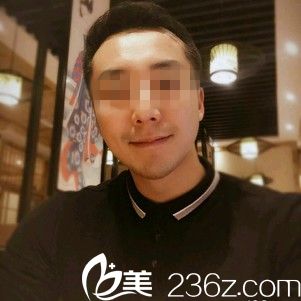 术后三天效果 术后三天效果