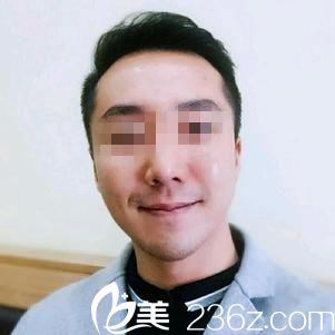 术后七天效果 术后七天效果