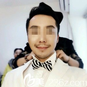 术后半个月效果 术后半个月效果