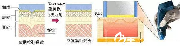 尹珍惠 热玛吉 尹珍惠 热玛吉