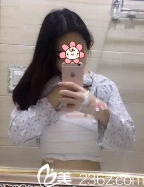 术后第二天 术后第二天