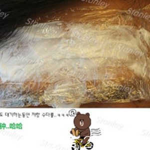 韩国史丹利整形医院玻尿酸除皱